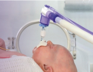 ventilazione invasiva neonatale